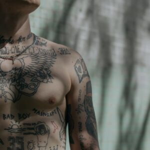 Αφαίρεση τατουάζ 1