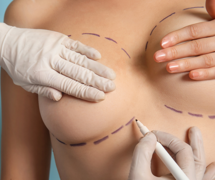 ανισομαστία woman being examined in breast by a doctor