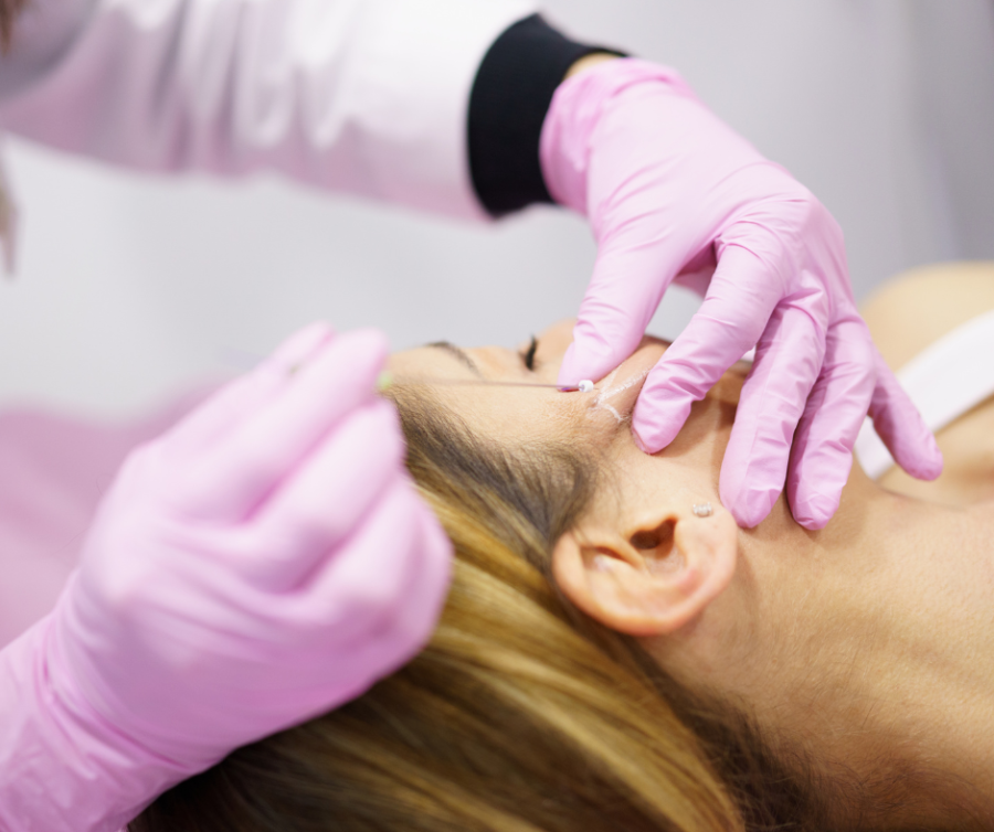νήματα woman having facial threads