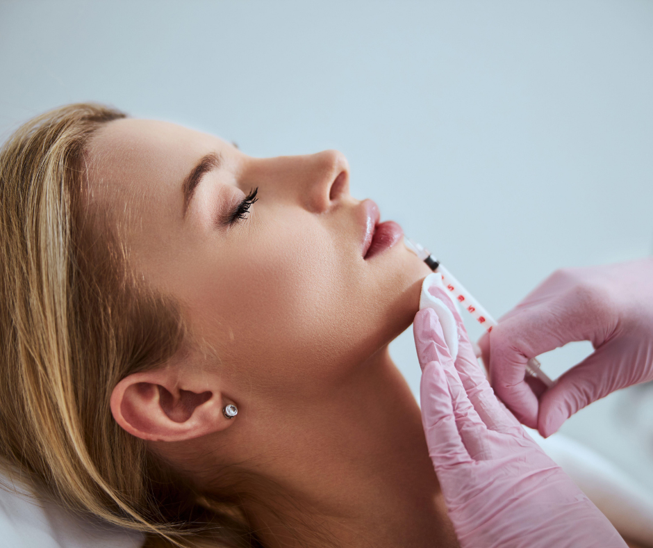 Συνδυασμός laser και fillers – εφαρμογή filler στο πρόσωπο