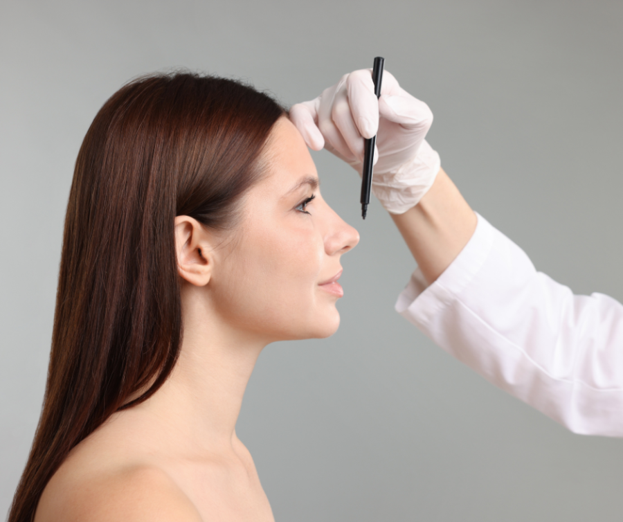 δευτερογενής ρινοπλαστική rhinoplasty
